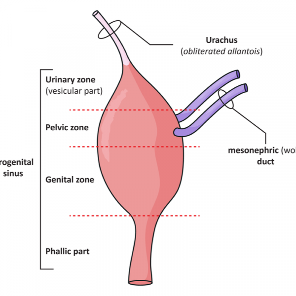 Urahu karcinoma