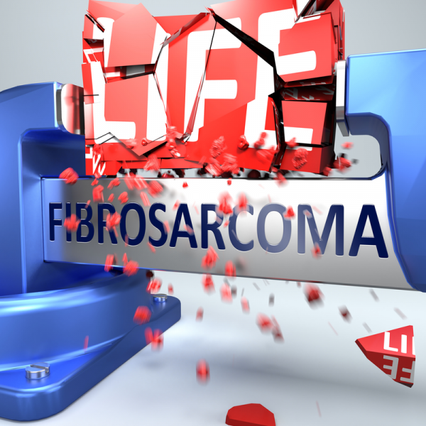 Fibrosarkoma