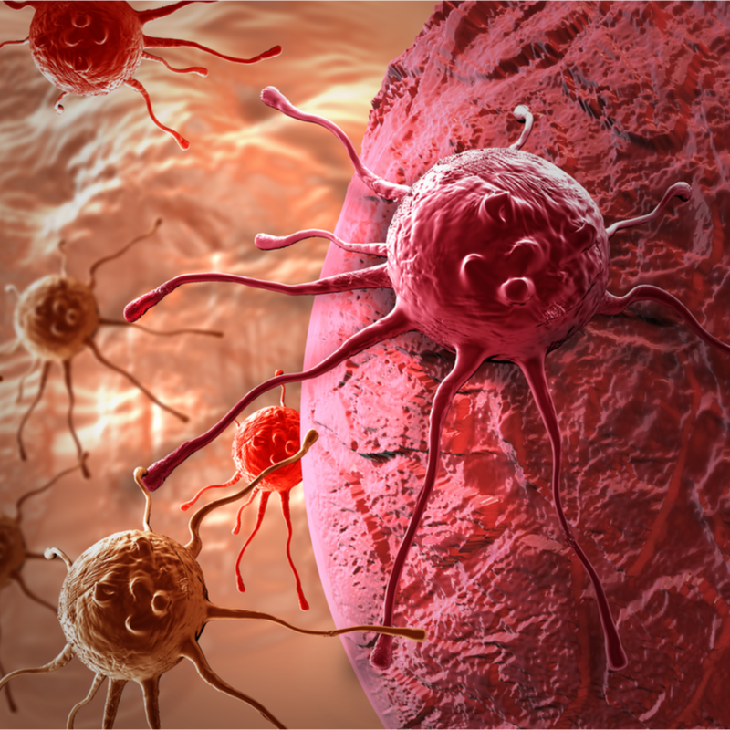 Medulloblastoma