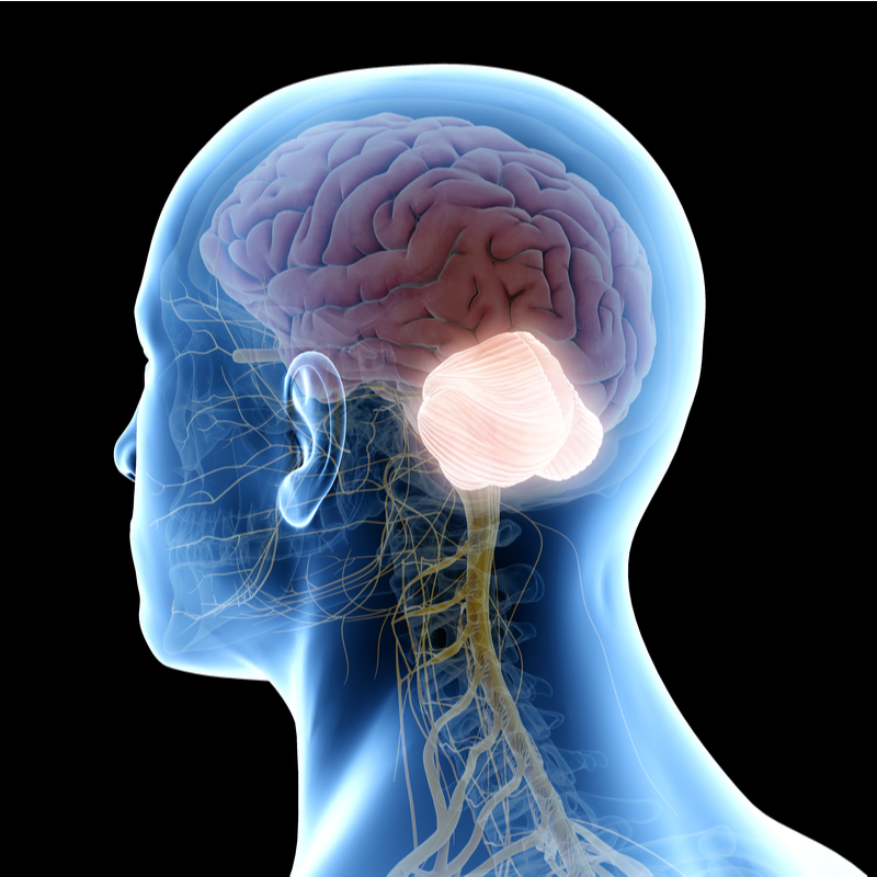 Lhermitte-Duclos syndrome