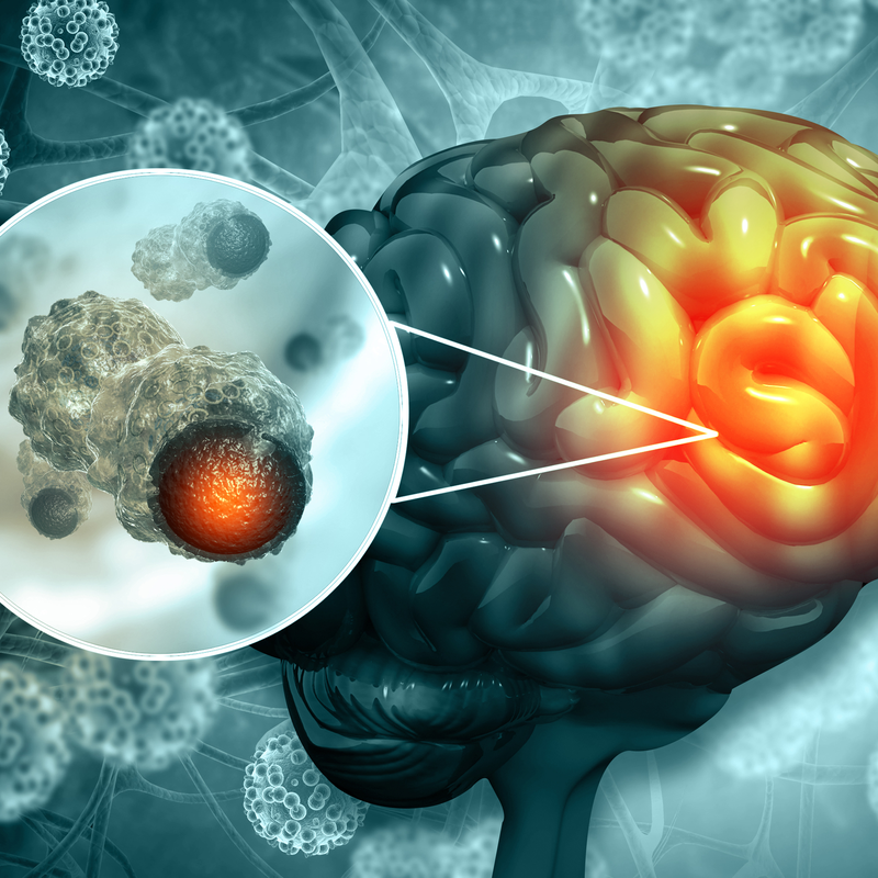 Ļaundabīgas meningiomas