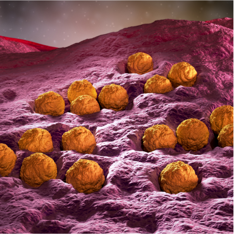Virus della rosolia - Rosolia