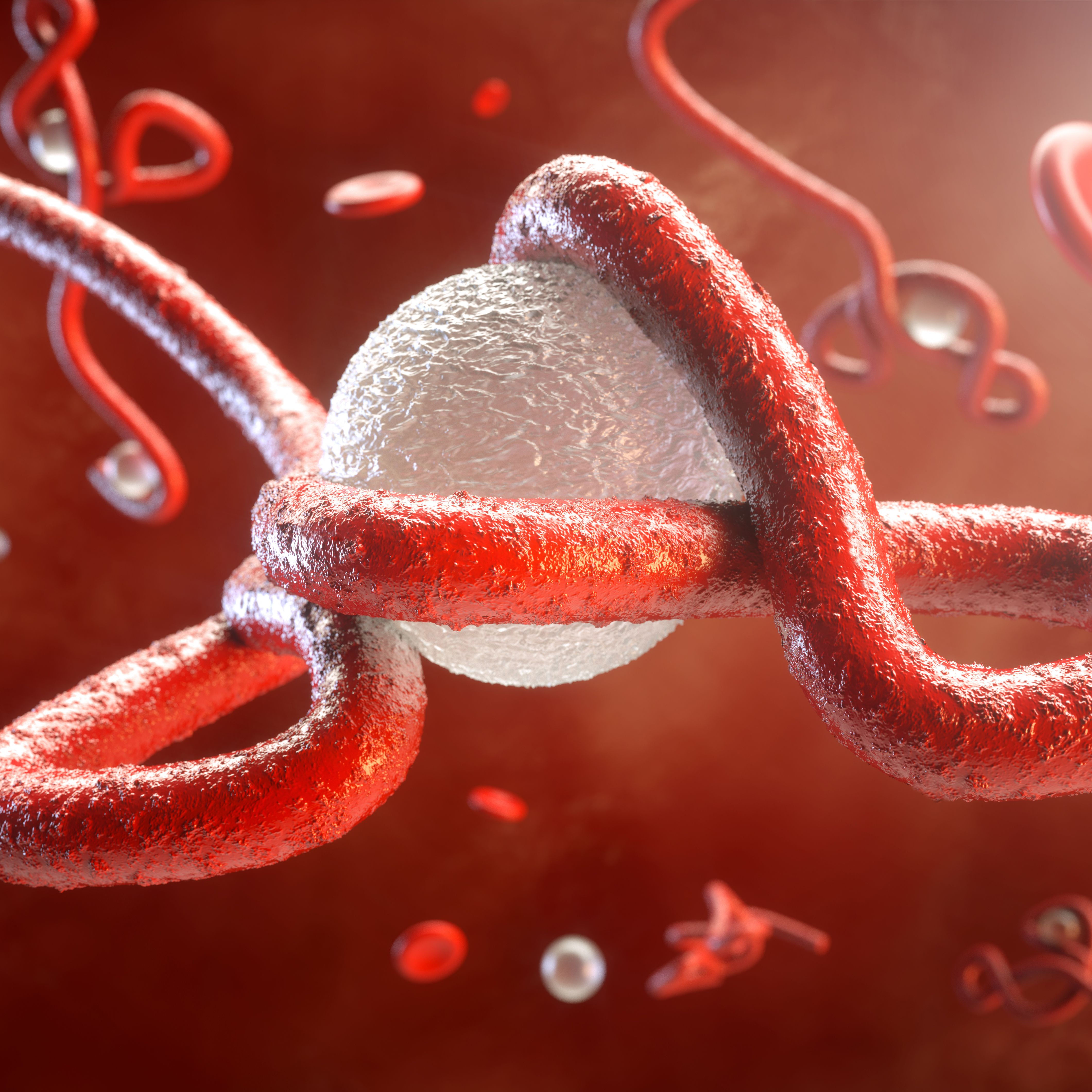 Le virus Ebola