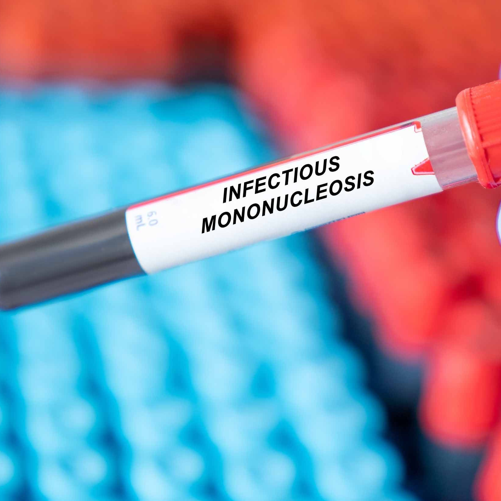 Mononukleose