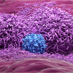 Carcinoma