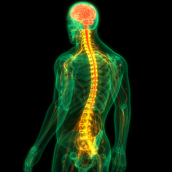 Syringomyelia