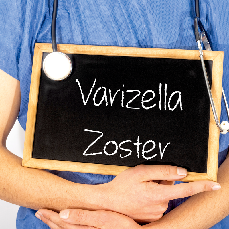Virus Varicella zoster