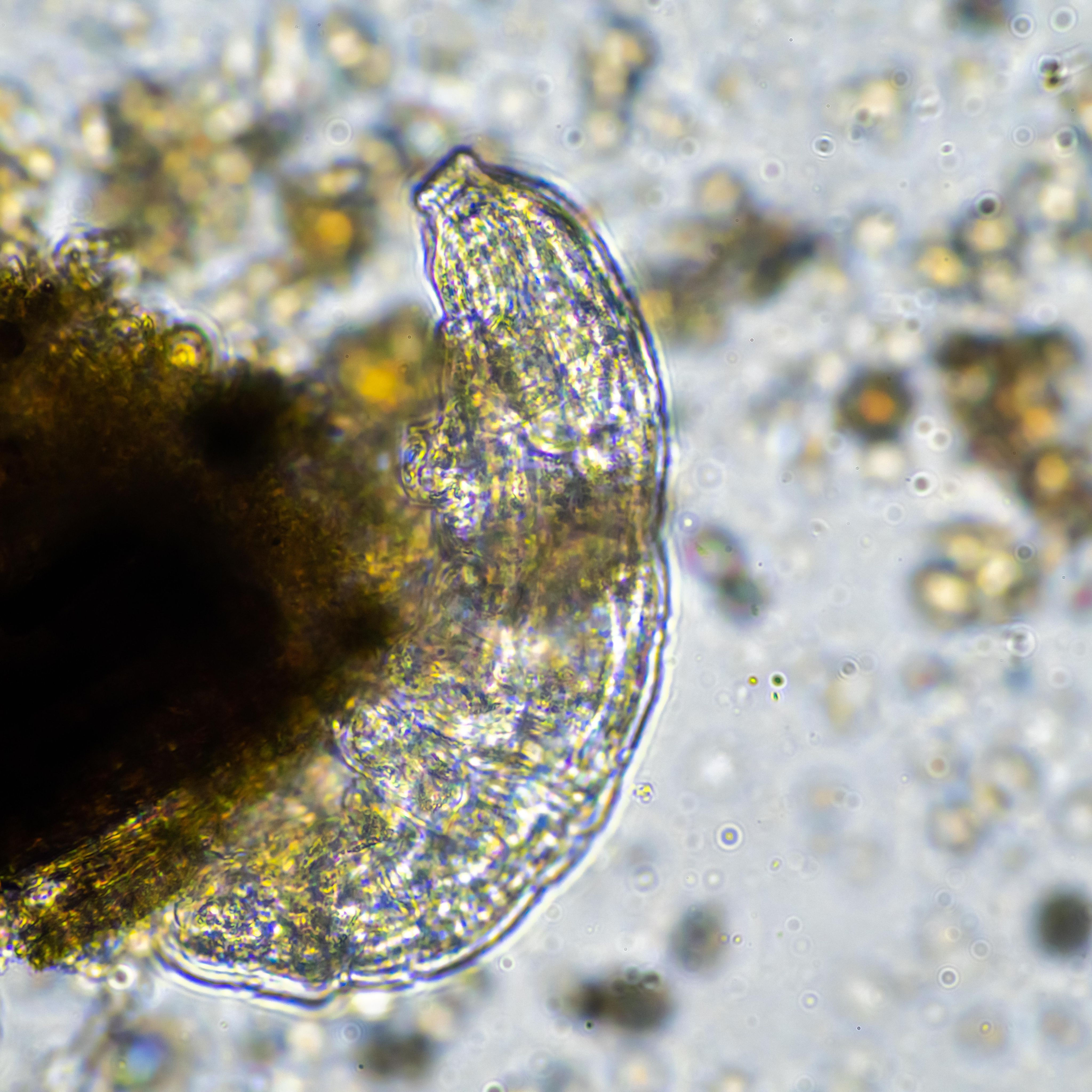 Bacteroides fragilis