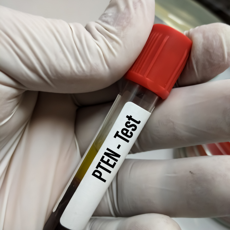 PTEN Hamartoma Tumour Syndrome