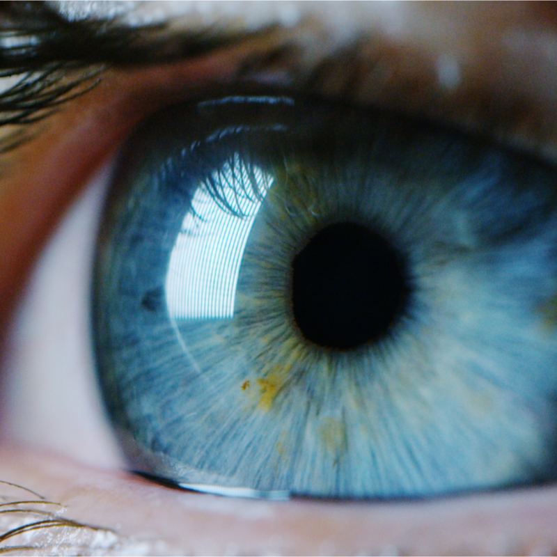 Retinoblastoma
