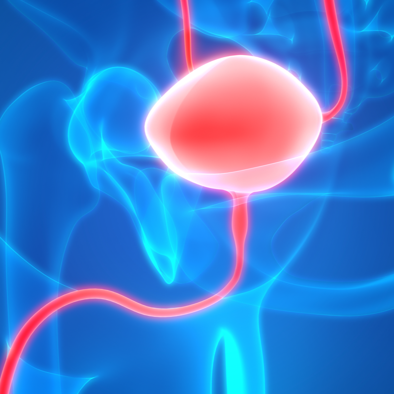 Urothelial papilloma