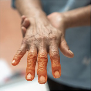 Polyneuropathie