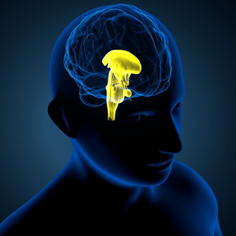 Craniopharyngeoma