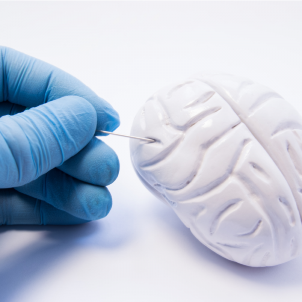 Glioma
