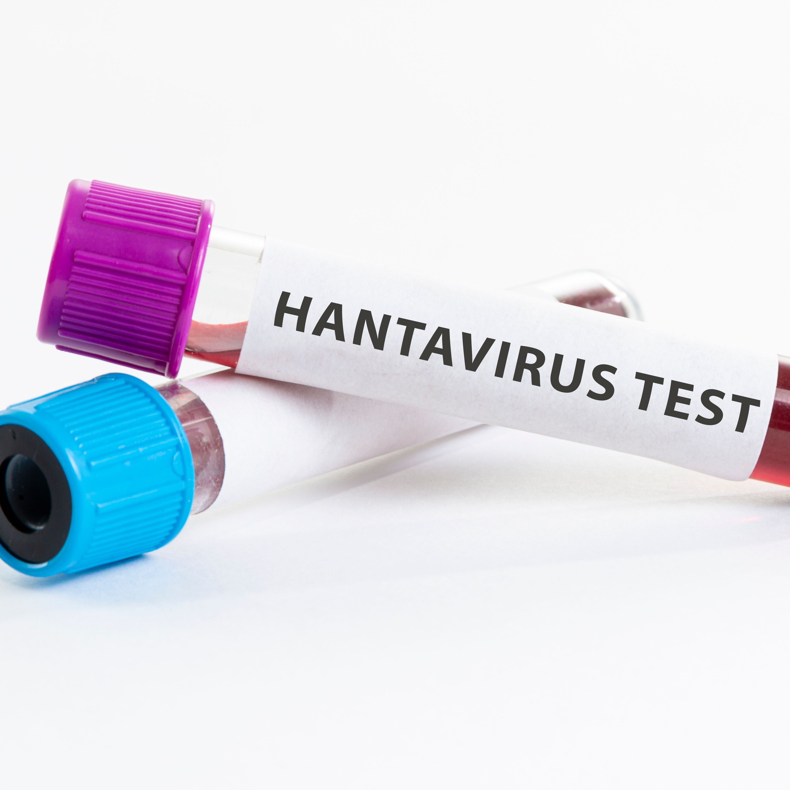 Hantavirus