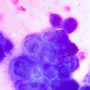 Histoplasma capsulatum